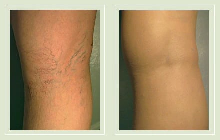 1-Second Airbrushed Leg Concealer