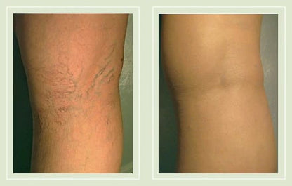 1-Second Airbrushed Leg Concealer